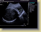 Week32-Siemens-Ultrasound-Dec2011 (2) * 1024 x 768 * (178KB)